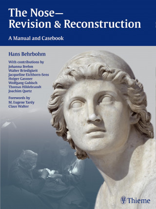 Hans Behrbohm, Jacqueline Eichhorn-Sens, Joachim Ulrich Quetz: The Nose - Revision and Reconstruction