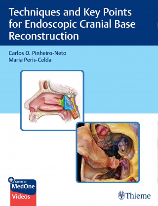 Carlos Pinheiro-Neto, Maria Peris-Celda: Techniques and Key Points for Endoscopic Cranial Base Reconstruction