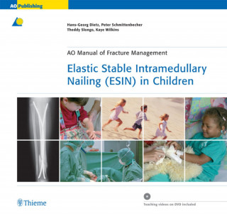 Hans-Georg Dietz, Peter P Schmittenbecher, Theddy Slongo, Kaye E. Wilkins: Elastic Stable Intramedullary Nailing (ESIN) in Children