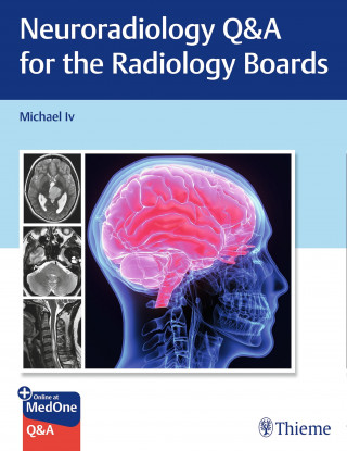 Michael Iv: Neuroradiology Q&A for the Radiology Boards