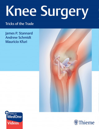 James Stannard, Andrew Schmidt, Mauricio Kfuri: Knee Surgery