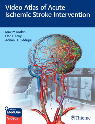 Maxim Mokin, Elad Levy, Adnan Siddiqui: Video Atlas of Acute Ischemic Stroke Intervention