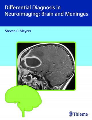 Differential Diagnosis in Neuroimaging: Brain and Meninges