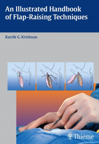 Kartik G. Krishnan: An Illustrated Handbook of Flap-Raising Techniques