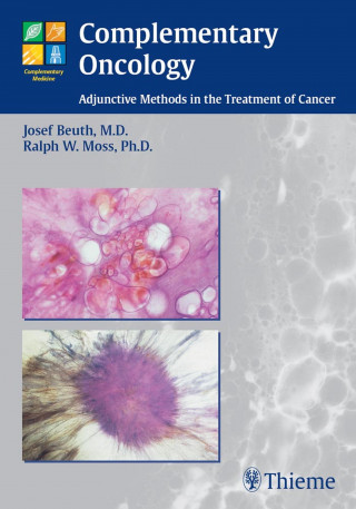 Josef Beuth, Ralph W. Moss: Complementary Oncology
