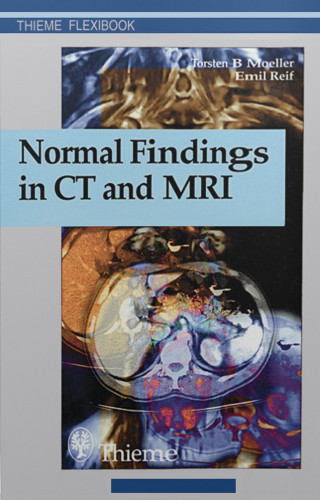 Torsten Bert Moeller, Emil Reif: Normal Findings in CT and MRI
