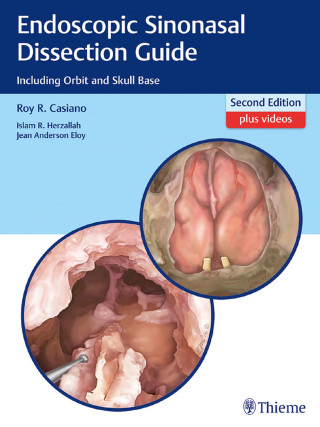 Roy R. Casiano, Islam Herzallah, Jean Eloy: Endoscopic Sinonasal Dissection Guide
