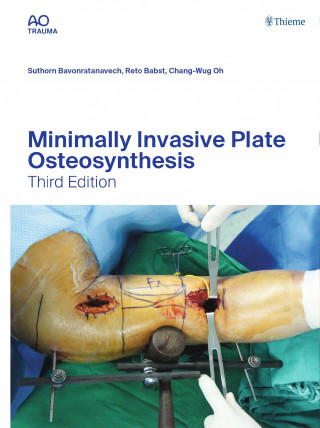 Suthorn Bavonratanavech, Reto Babst, Chang-Wug Oh: Minimally Invasive Plate Osteosynthesis