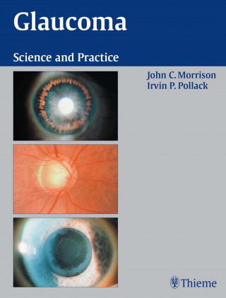 John C. Morrison, Irvin P. Pollack: Glaucoma