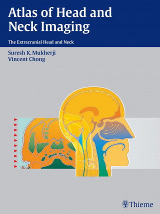 Suresh Kumar Mukherji, Vincent Chong: Atlas of Head and Neck Imaging