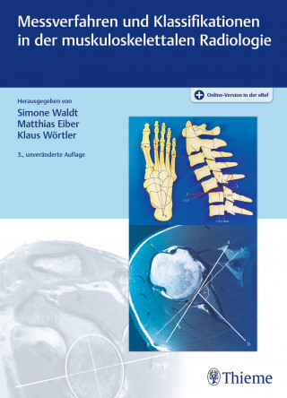 Simone Waldt, Matthias Eiber, Klaus Wörtler: Messverfahren und Klassifikationen in der muskuloskelettalen Radiologie