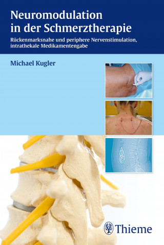 Michael Kugler: Neuromodulation in der Schmerztherapie