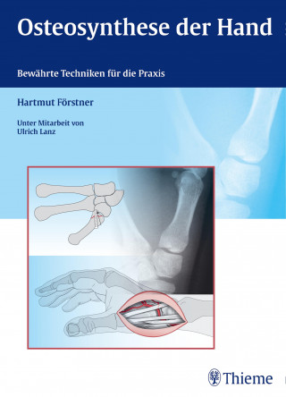 Hartmut Förstner: Osteosynthese der Hand