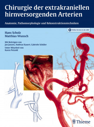 Hans Scholz, Matthias Wunsch: Chirurgie der extrakraniellen hirnversorgenden Arterien