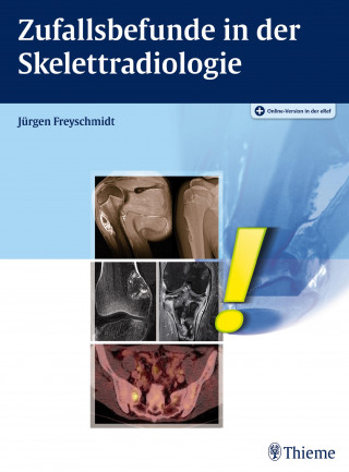 Jürgen Freyschmidt: Zufallsbefunde in der Skelettradiologie