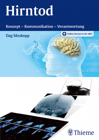 Dag Moskopp: Hirntod
