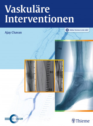 Vaskuläre Interventionen