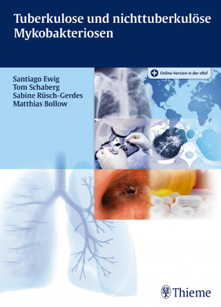 Santiago Ewig, Tom Schaberg, Sabine Rüsch-Gerdes, Matthias Bollow: Tuberkulose und nicht tuberkulöse Mykobakteriosen