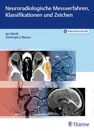 Jan Mariß, Christoph J. Maurer: Neuroradiologische Messverfahren, Klassifikationen und Zeichen