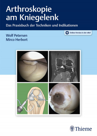 Wolf Petersen, Mirco Herbort: Arthroskopie am Kniegelenk