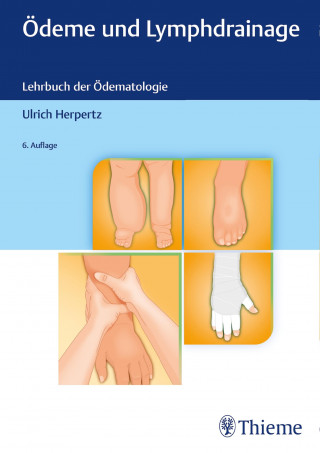 Ulrich Herpertz: Ödeme und Lymphdrainage