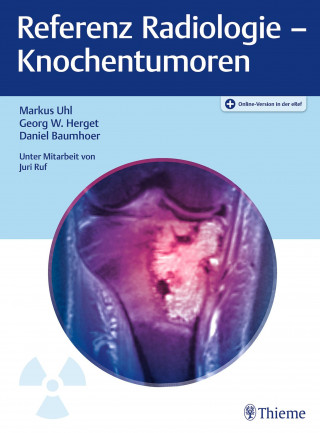 Markus Uhl, Georg W. Herget, Daniel Baumhoer: Referenz Radiologie - Knochentumoren