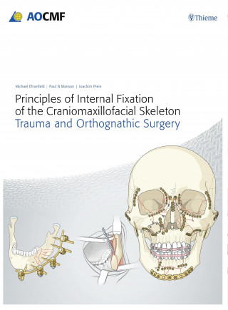 Joachim Prein, Michael Ehrenfeld, Paul N. Manson: Principles of Internal Fixation of the Craniomaxillofacial Skeleton