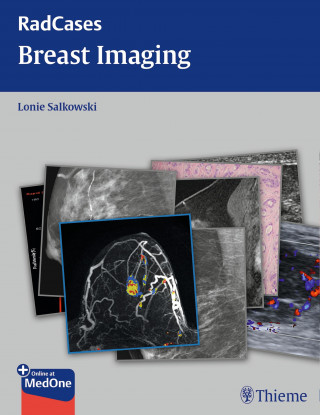Lonie L. Salkowski: Radcases Breast Imaging