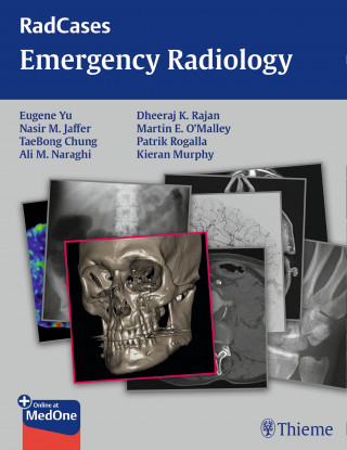 Eugene Yu, Nasir Jaffer, TaeBong Chung, Ali M. Naraghi, Dheeraj Rajan, Kieran Murphy, Martin O'Malley: Radcases Emergency Radiology