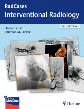 Hector Ferral, Jonathan M. Lorenz: RadCases Q&A Interventional Radiology