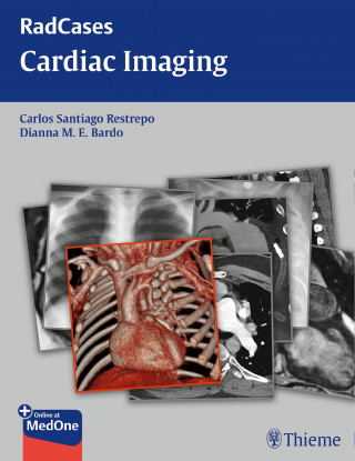 Carlos S Restrepo, Dianna M. E. Bardo: Radcases Cardiac Imaging
