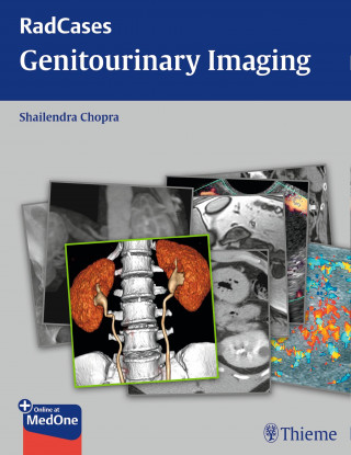 Shailendra Chopra: Radcases Genitourinary Imaging
