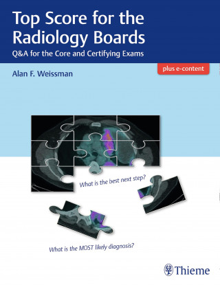 Alan Weissman: Top Score for the Radiology Boards