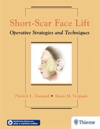 Patrick Tonnard, Alexis Verpaele: Short-Scar Face Lift