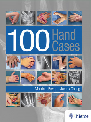 Martin Boyer, James Chang: 100 Hand Cases