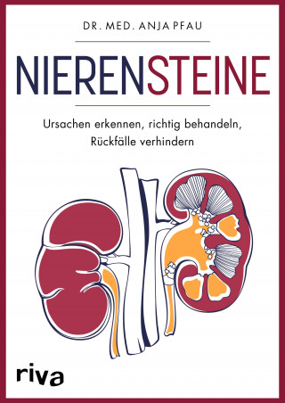 Anja Pfau: Nierensteine – Ursachen erkennen, richtig behandeln, Rückfälle verhindern